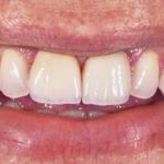 Zobne luske pomagajo odpravljati številne težave