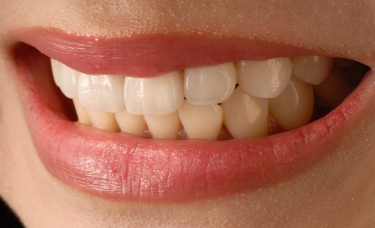 Življenjska doba zobnih lusk